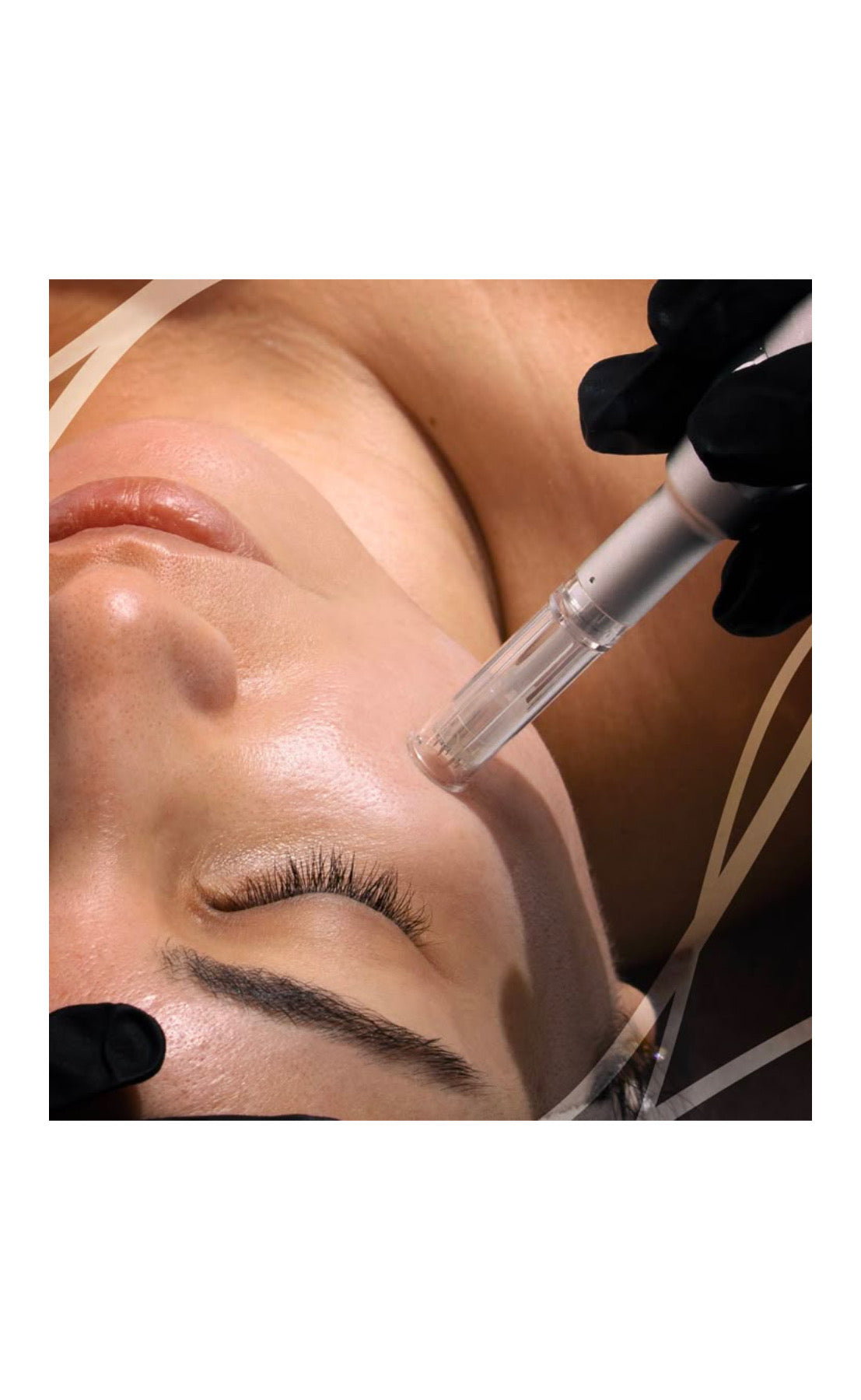 Tratamiento SkinRetin Expert facial