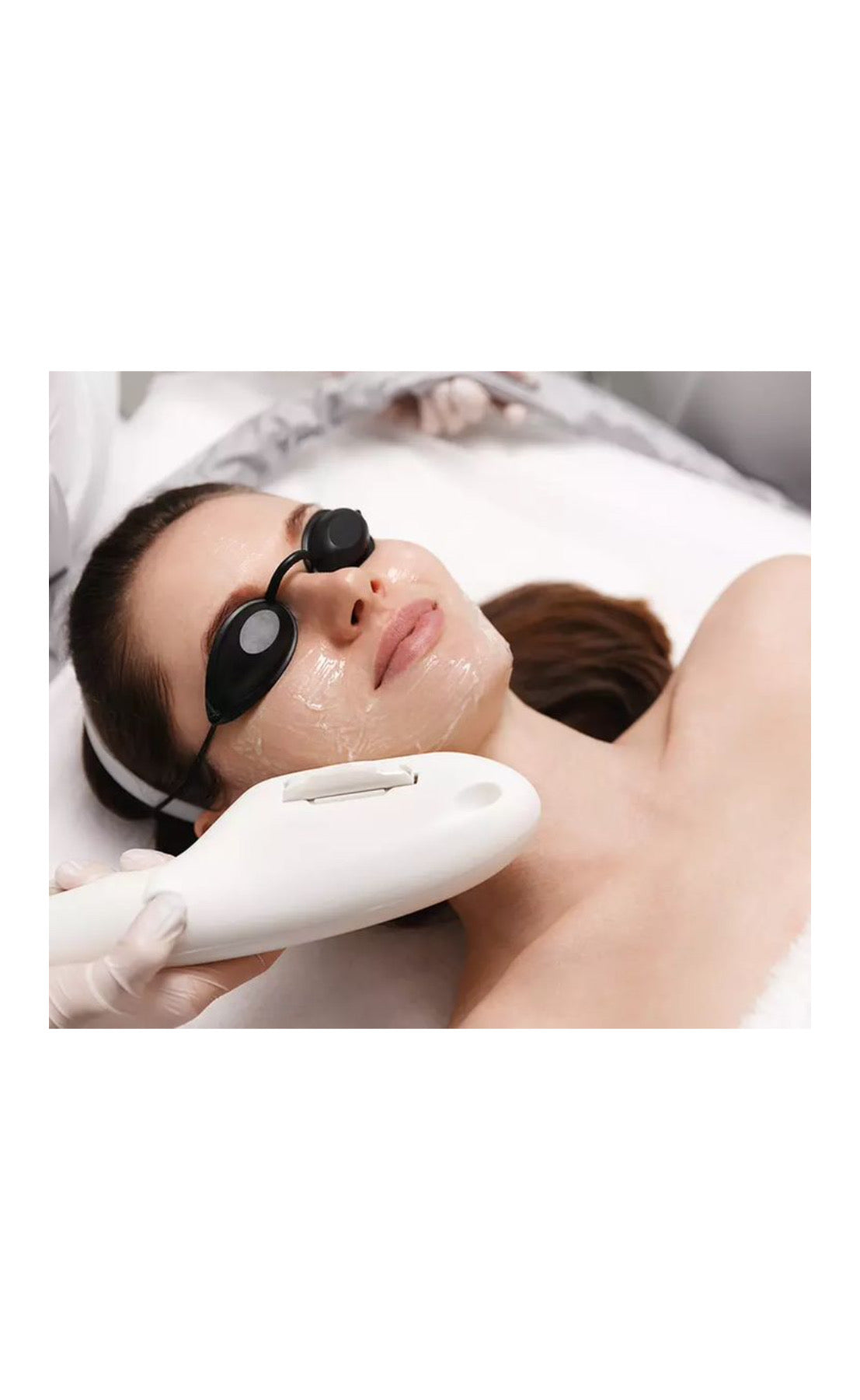 Fotorrejuvenecimiento con Luz Pulsada